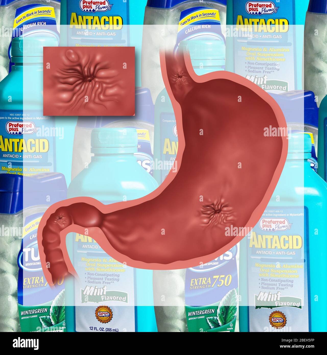 Stomach Ulcers and Antacid, Illustration Stock Photo Alamy