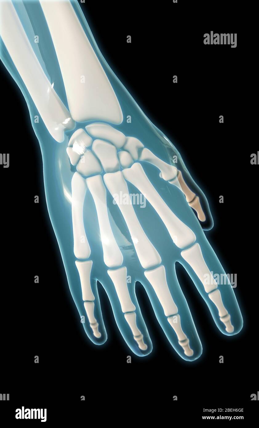 Bones of the Hand, Dorsal View Stock Photo