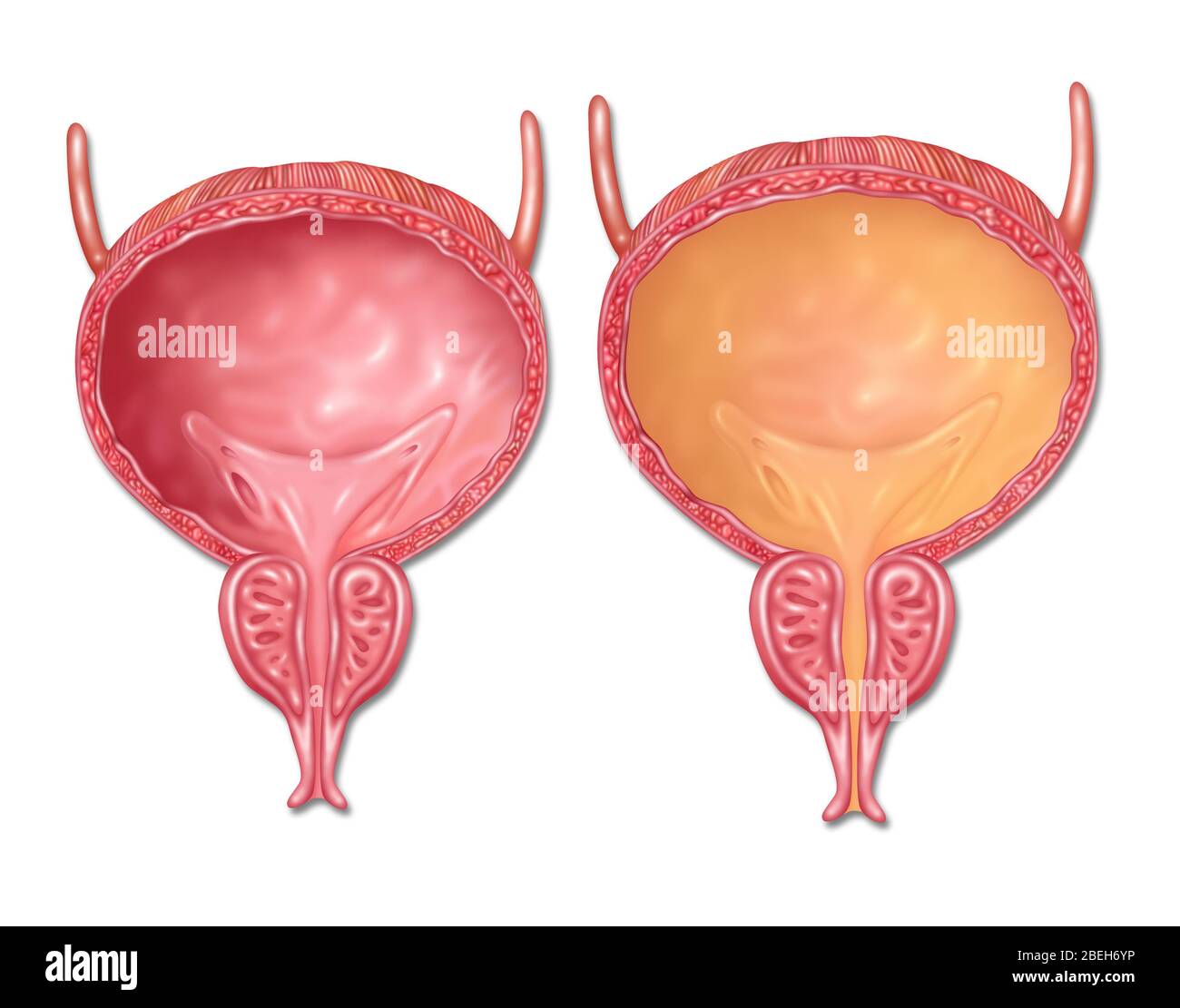 Empty and Full Bladder, Illustration Stock Photo - Alamy
