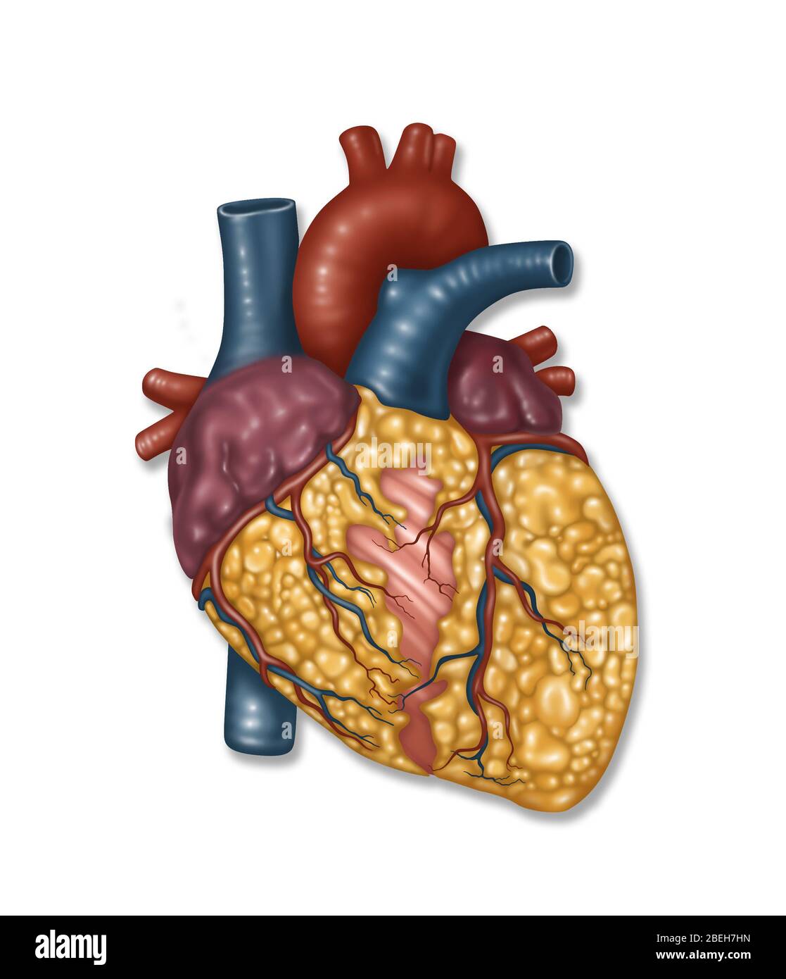 Unhealthy Heart, Illustration Stock Photo Alamy