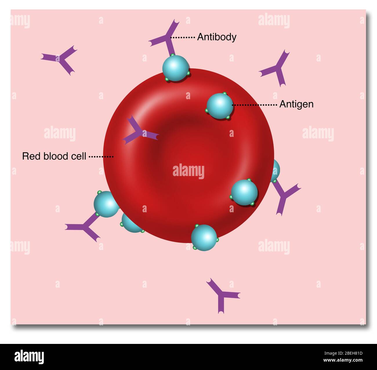 Antigens, Antibodies, and Transfusion Reactions - StoryMD, image size:1300x1276