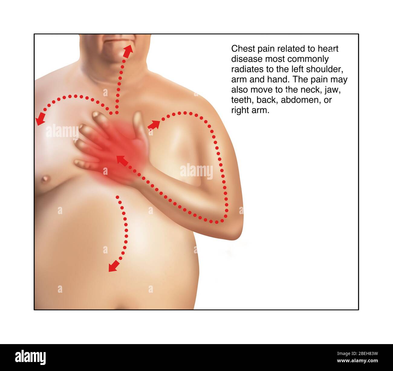 Chest pain right side and back