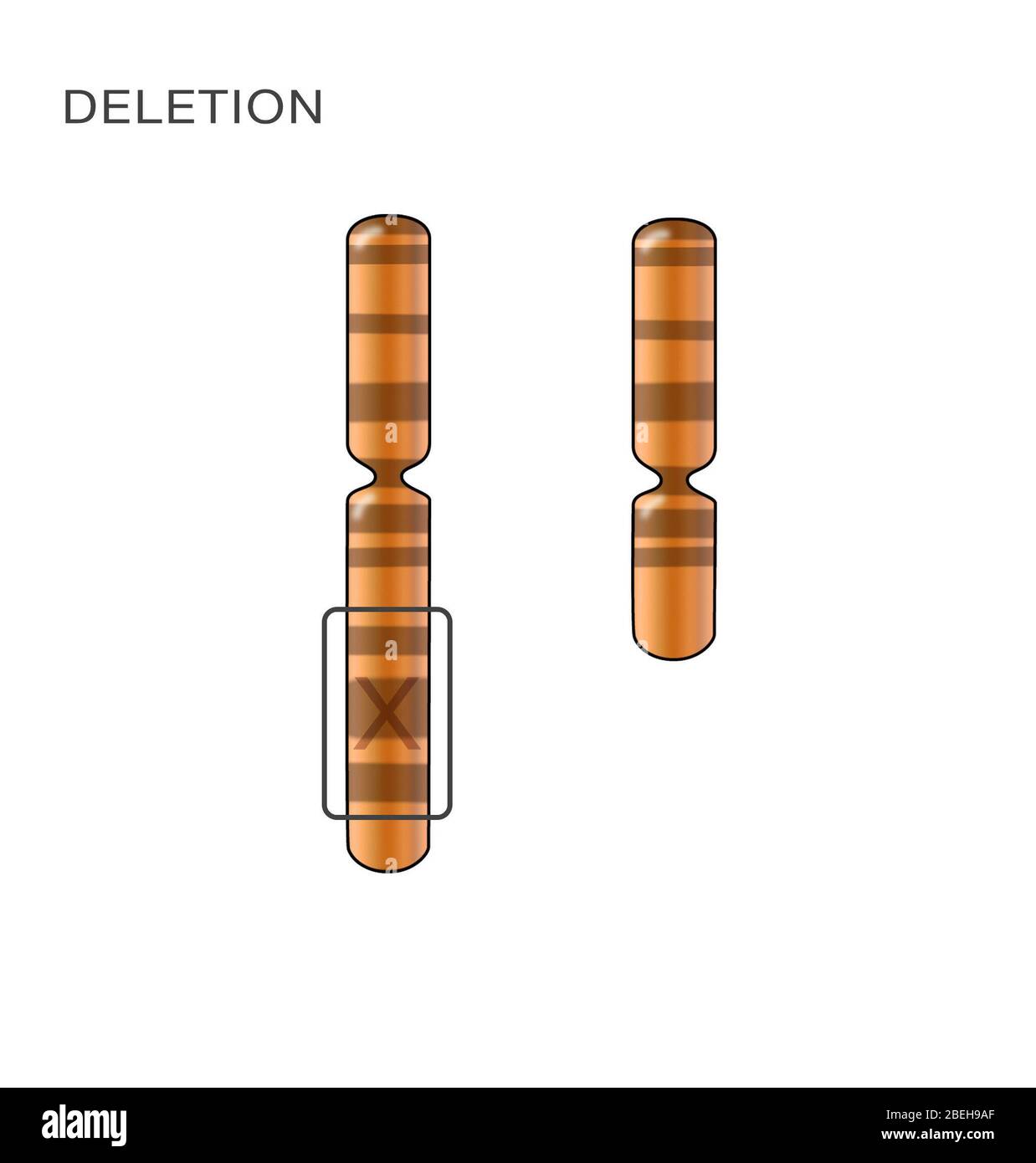 Chromosome Deletion, Illustration Stock Photo Alamy