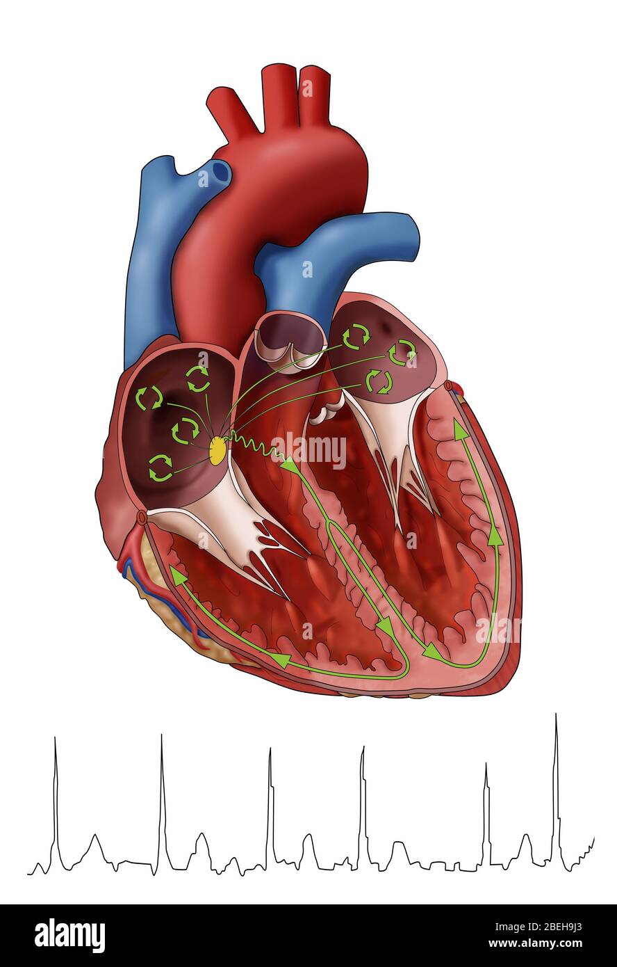 Atrial Fibrillation with EKG, Illustration Stock Photo