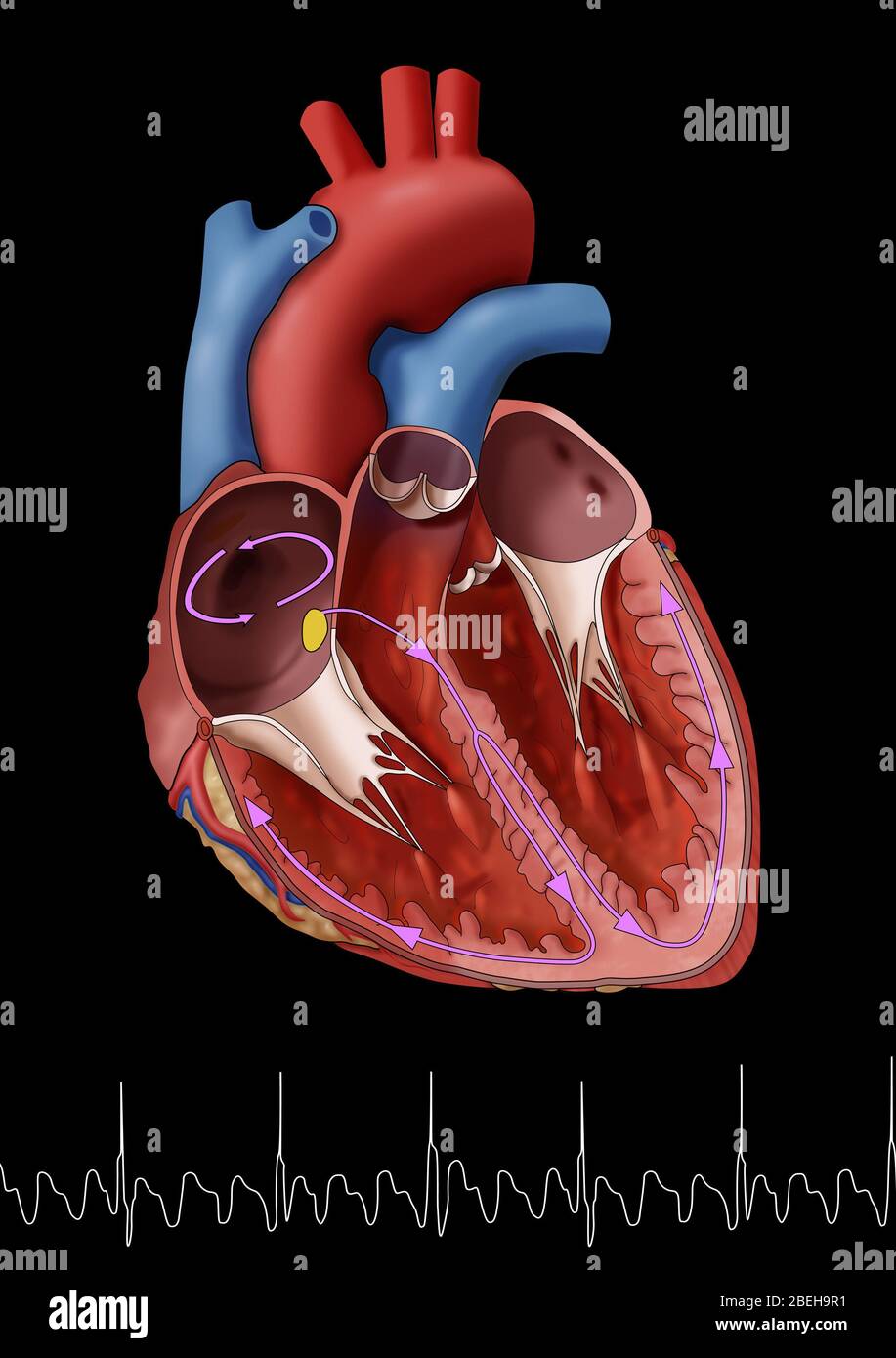 Atrial Flutter with EKG, Illustration Stock Photo