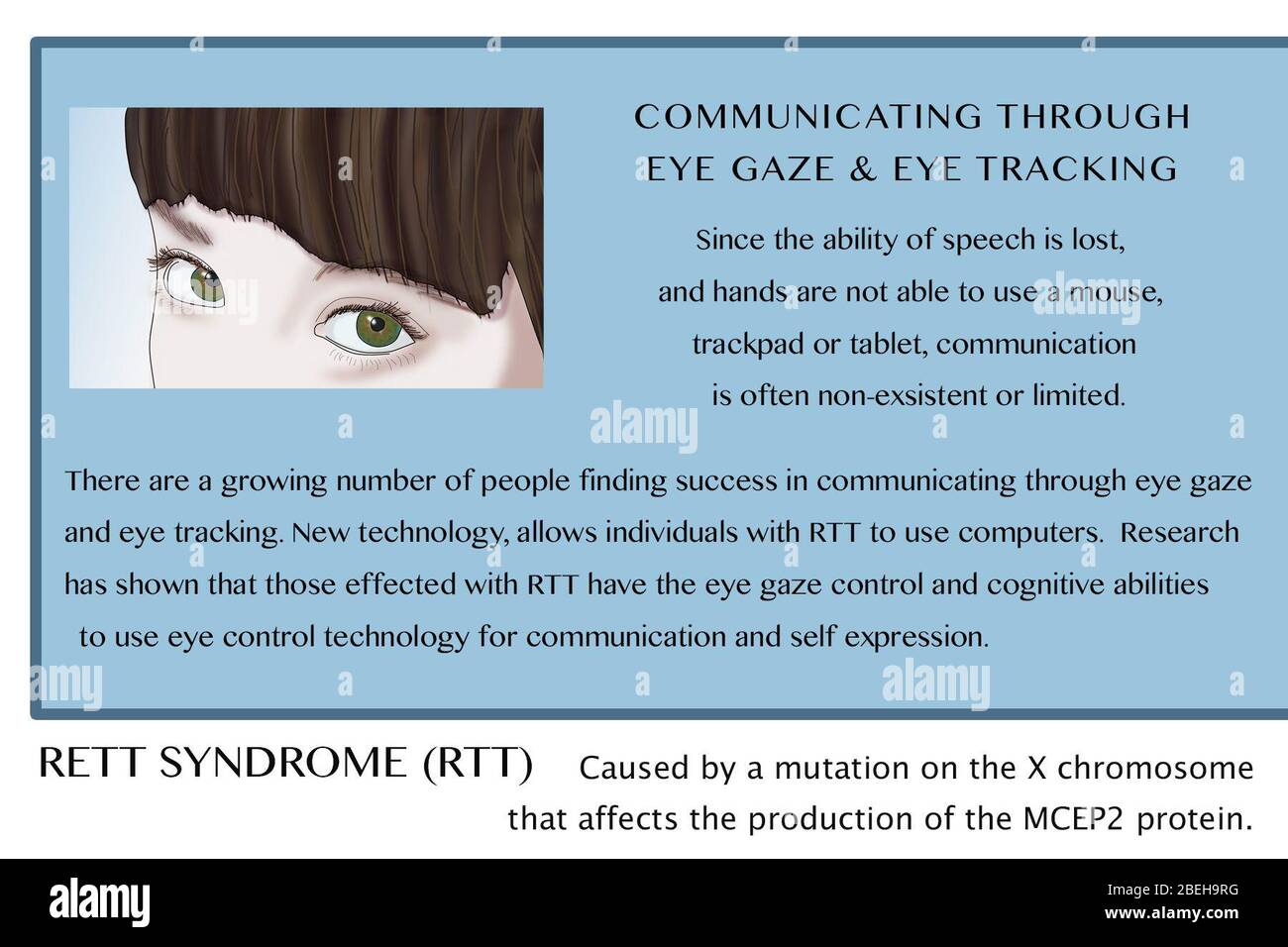 Rett Syndrome, Illustration Stock Photo