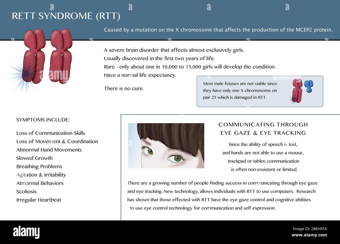 Rett Syndrome, Illustration Stock Photo