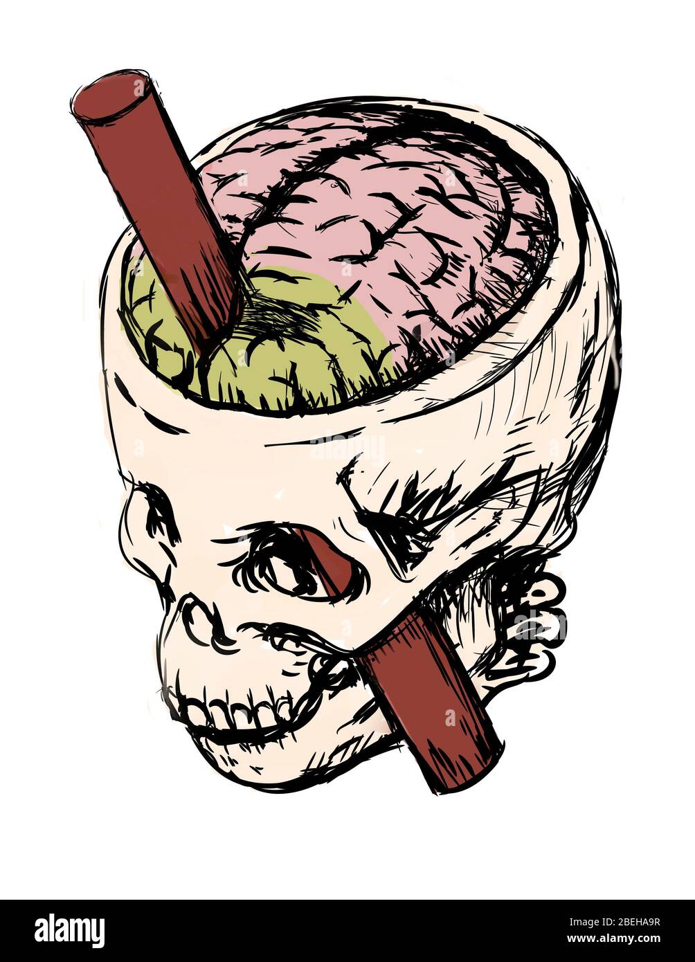 Brain Injury of Phineas Gage, Illustration Stock Photo