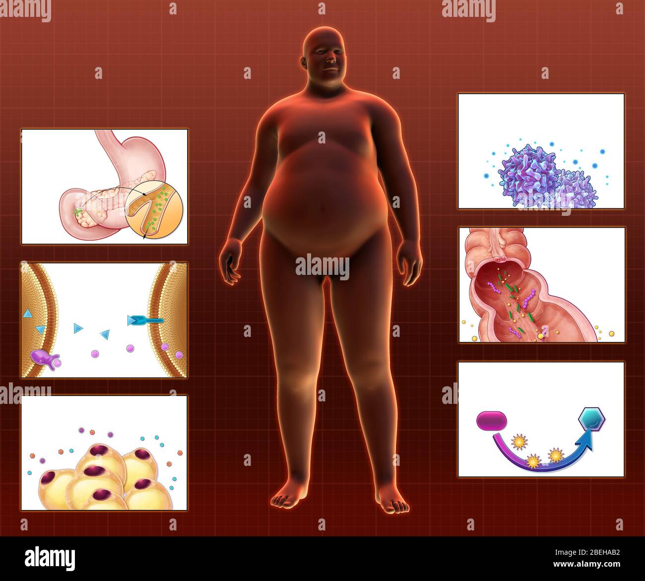 Effects of Obesity Stock Photo
