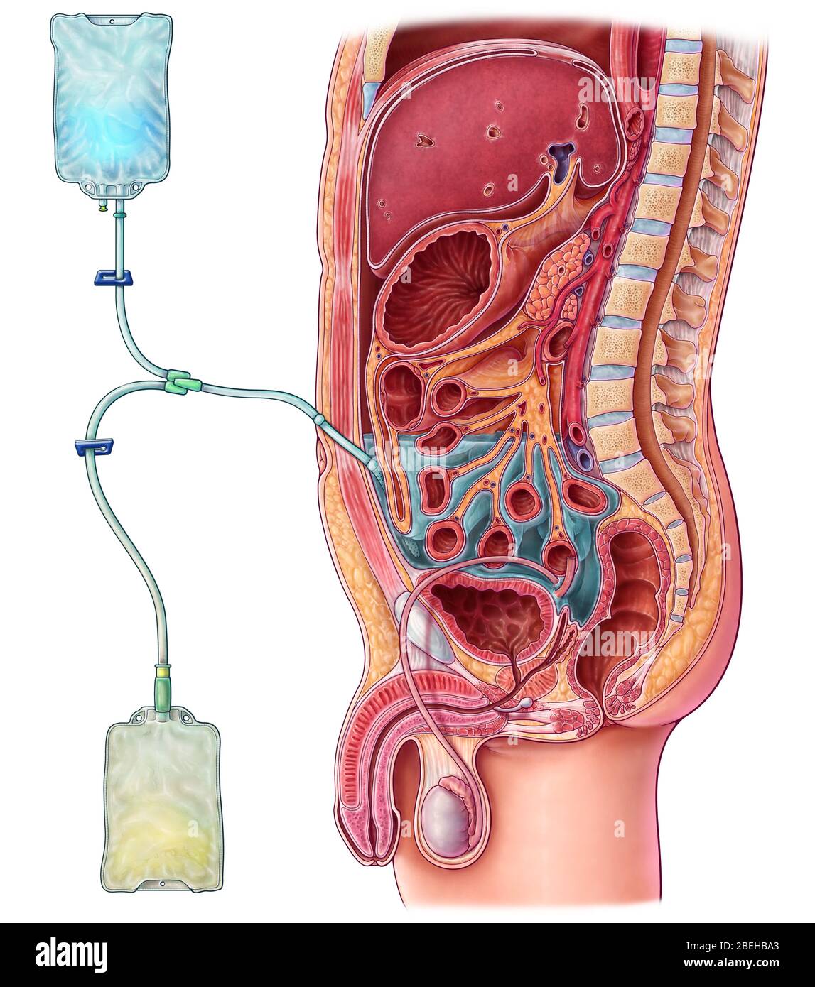 Peritoneal Dialysis Machine Travel Case: Tips and Recommendations for Traveling with Medical Equipment 1 Peritoneal Dialysis Machine Travel Case