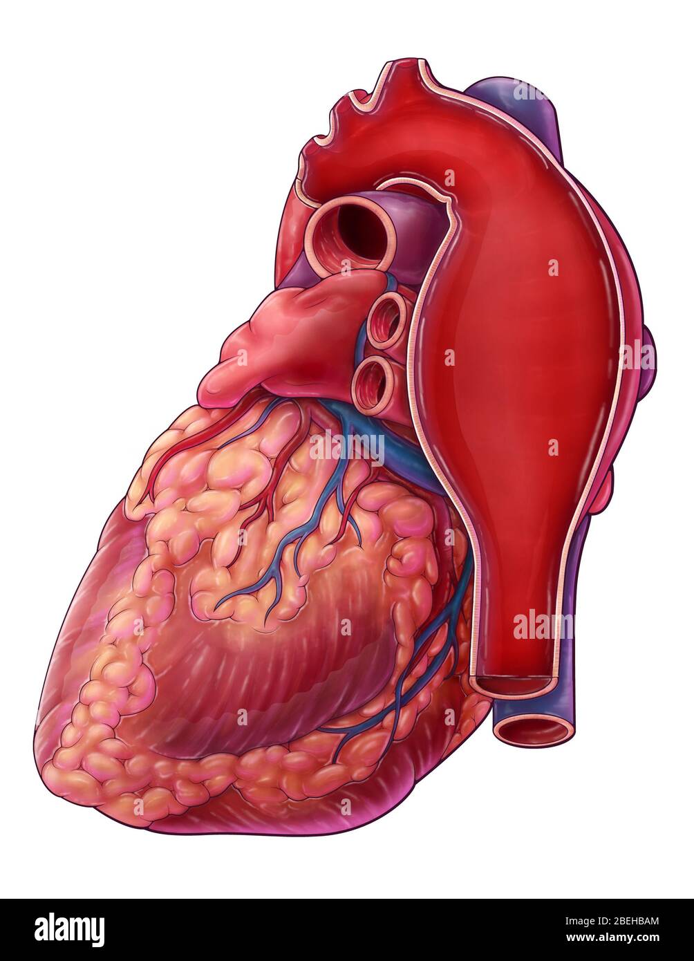 Thoracic Aortic Aneurysm, Illustration Stock Photo