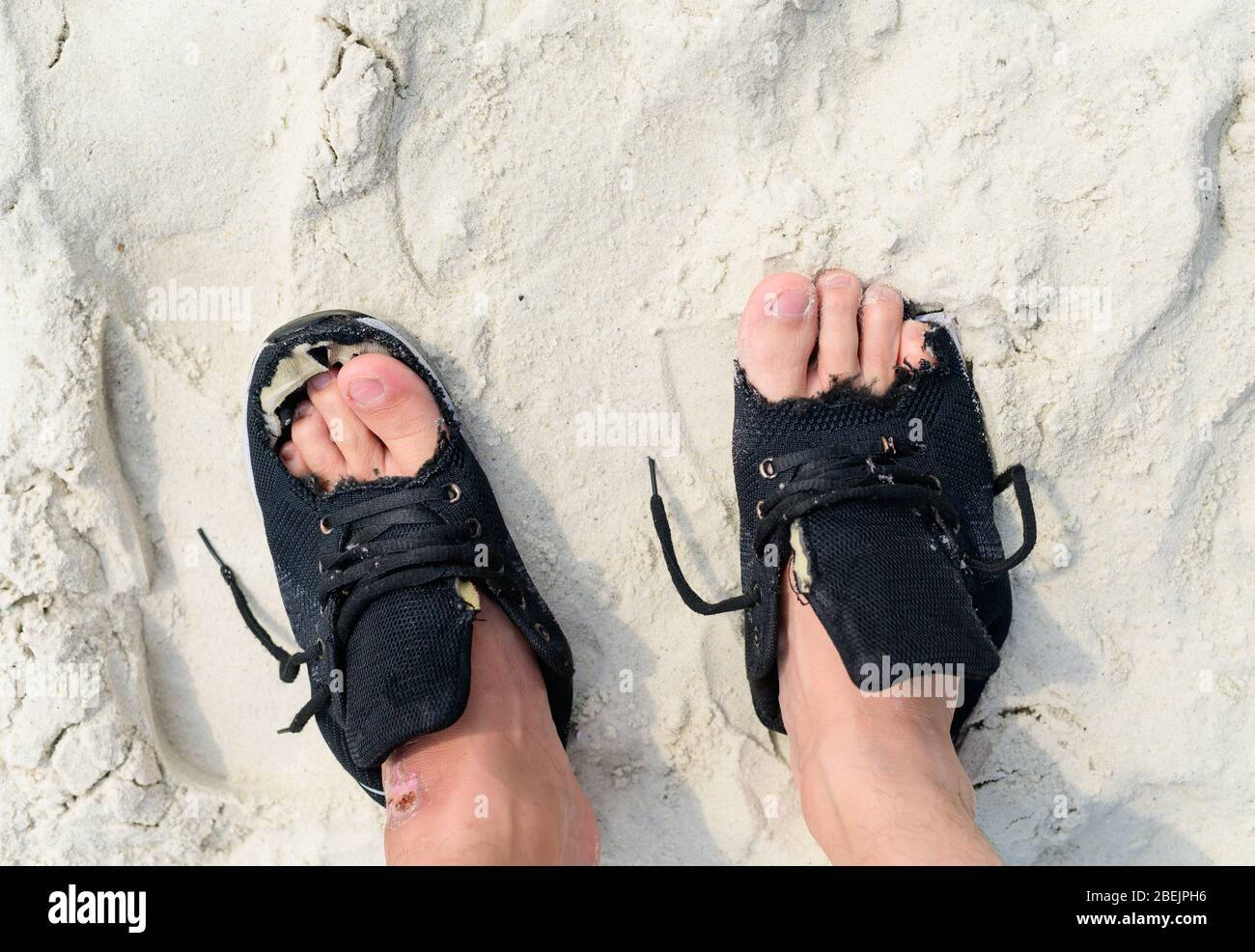 Old worn shoes on feet with human finger in holes Stock Photo Alamy