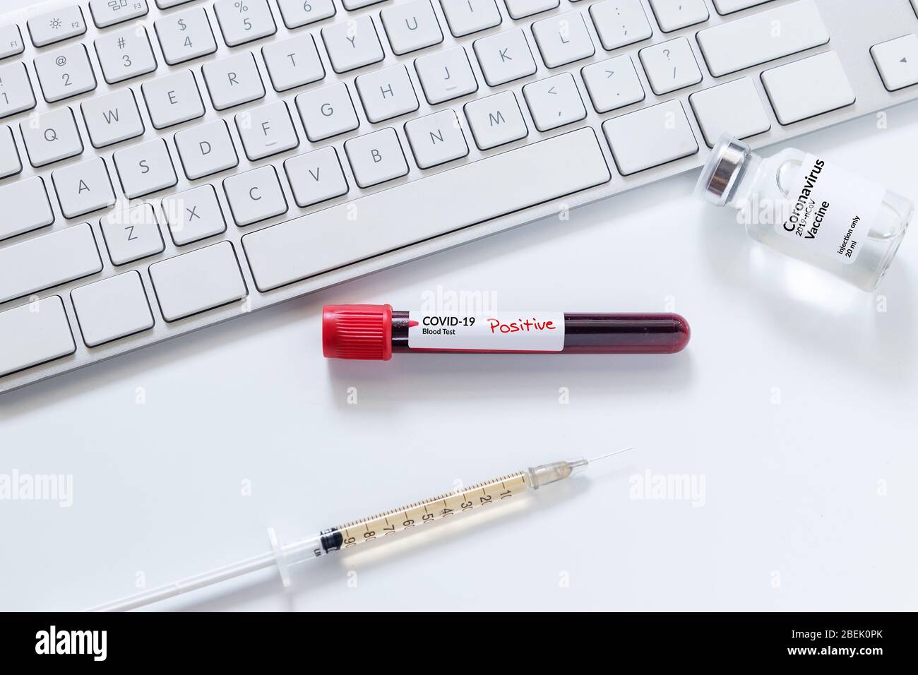 Coronavirus blood sample in test tube for covid-19 analyzing with positive results. laboratory analyzing for testing and invent drug and vaccine durin Stock Photo