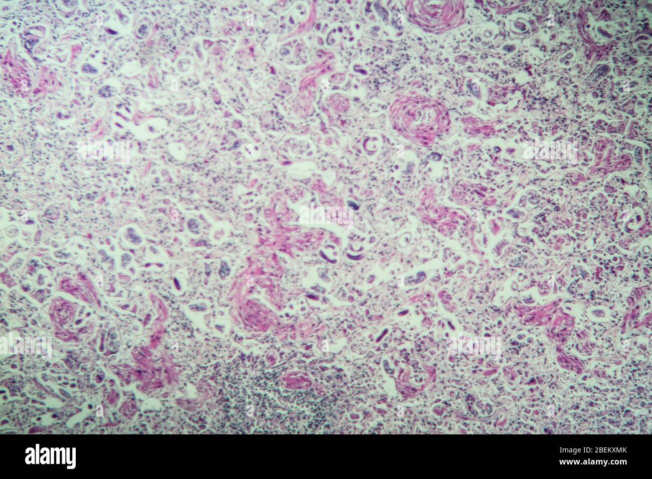 Lungworm under the microscope 100x Stock Photo Alamy