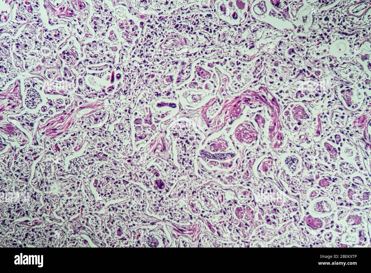 Lungworm under the microscope 100x Stock Photo Alamy