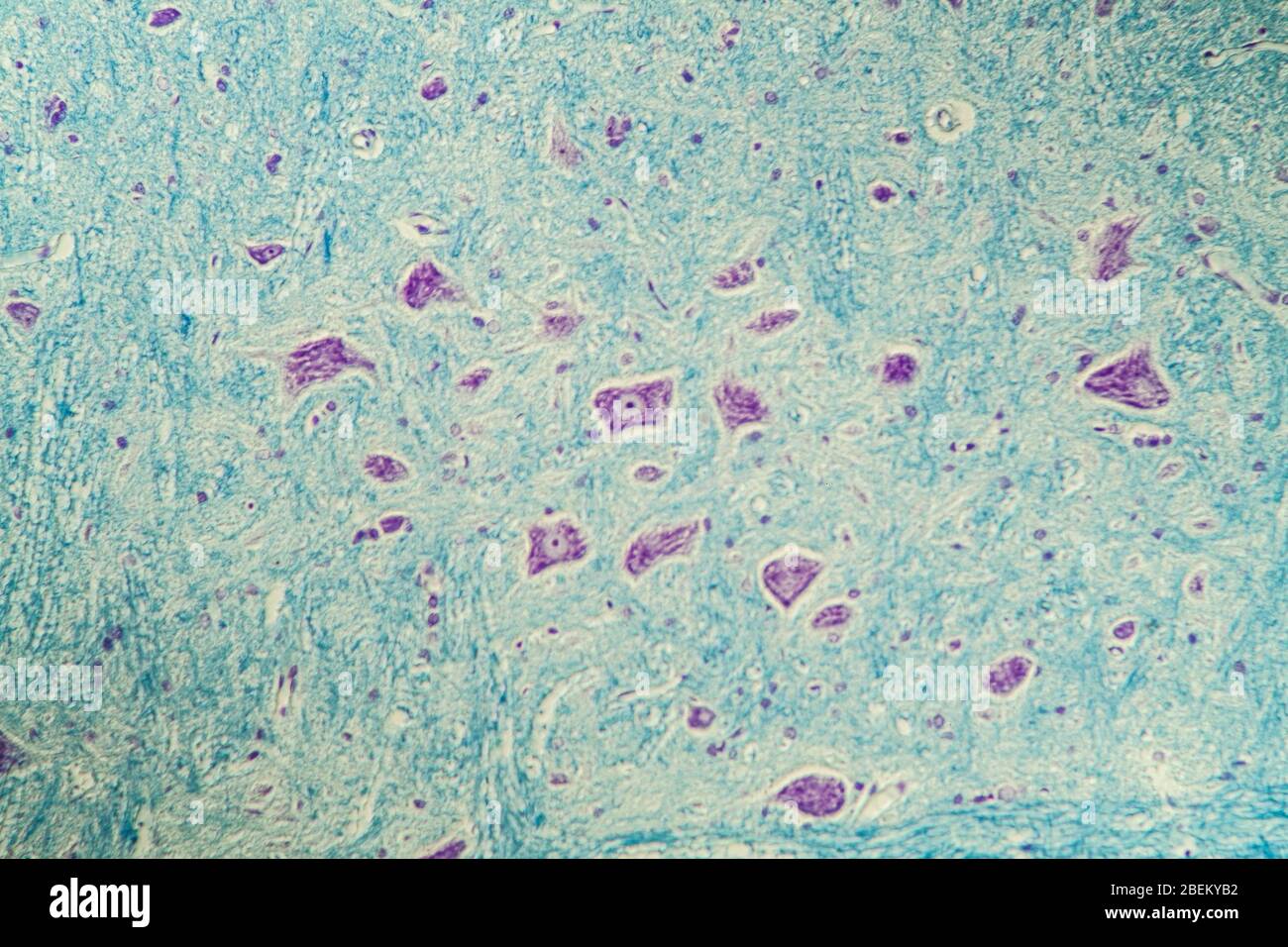 Nerve cells under the microscope 200x Stock Photo Alamy