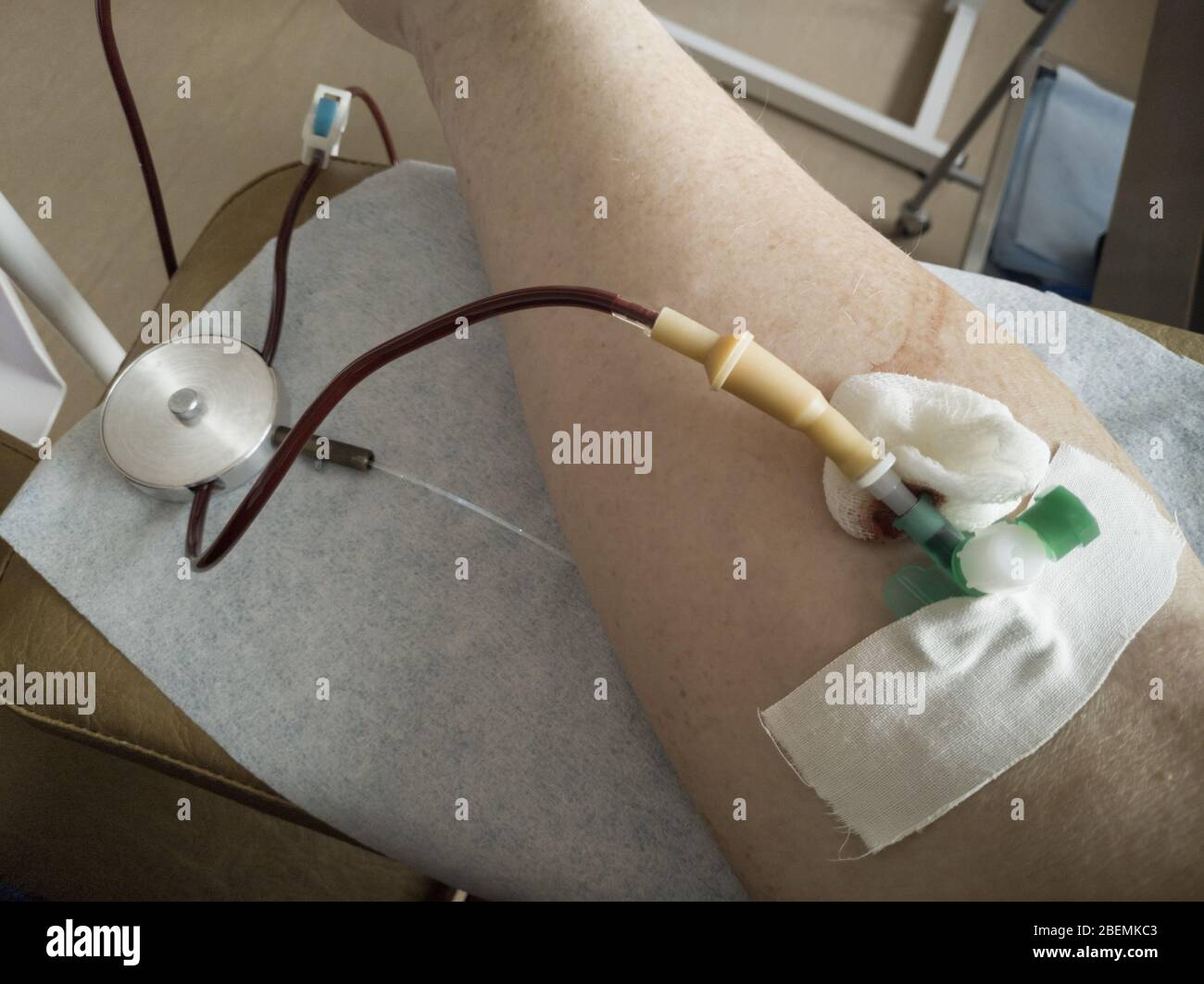 Catheter bag hires stock photography and images Alamy