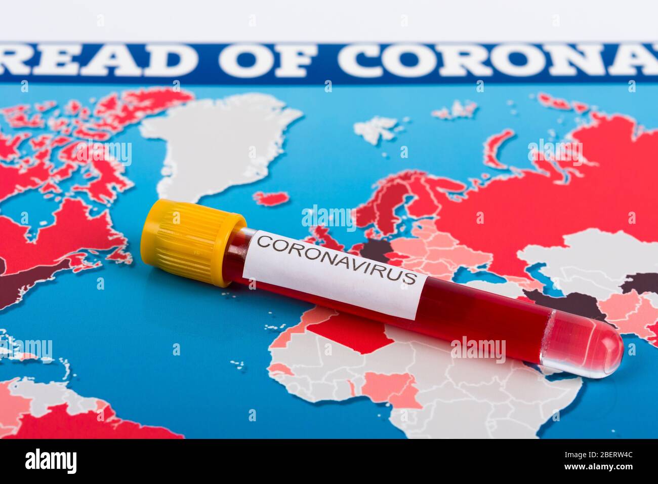 World Map Of Coronavirus And Blood Sample Countries With Covid 19 Covid 19 Map Confirmed Cases Report Worldwide Globally Border Control And Quarant Stock Photo Alamy