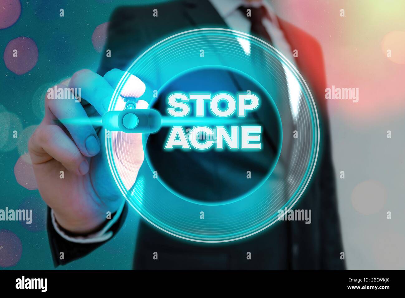 writing-note-showing-stop-acne-business-concept-for-control-the