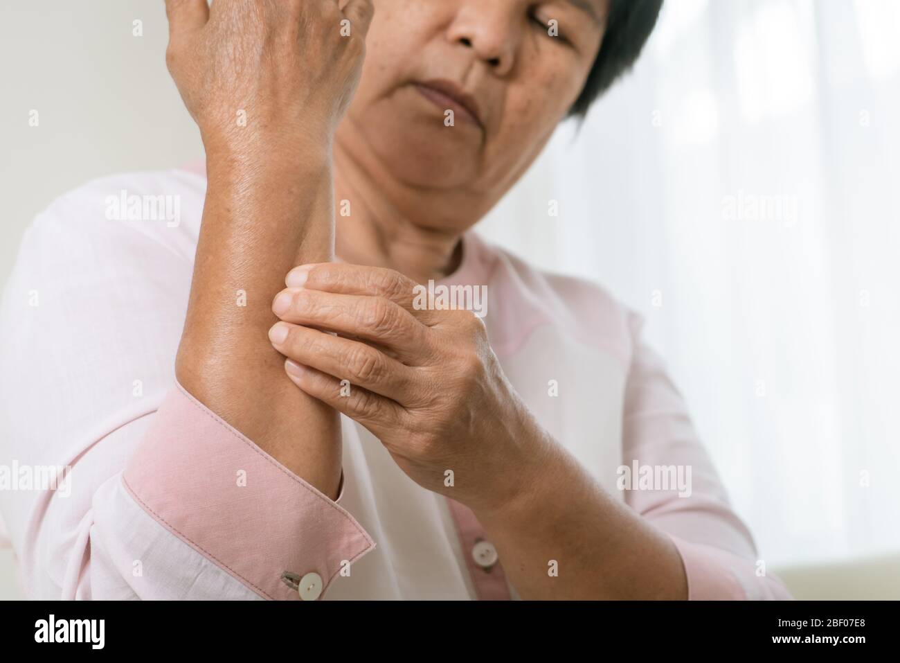 senior women scratch arm the itch on eczema arm, healthcare and medicine concept Stock Photo