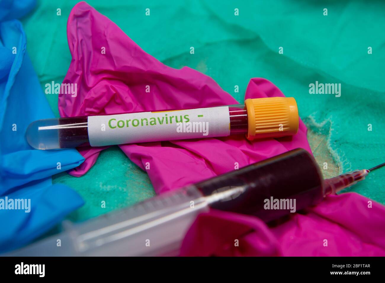 Tube with blood and negative test at coronavirus.. Stock Photo