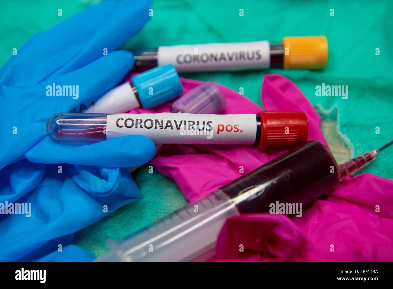 Tube with blood and positive test at coronavirus.. Stock Photo