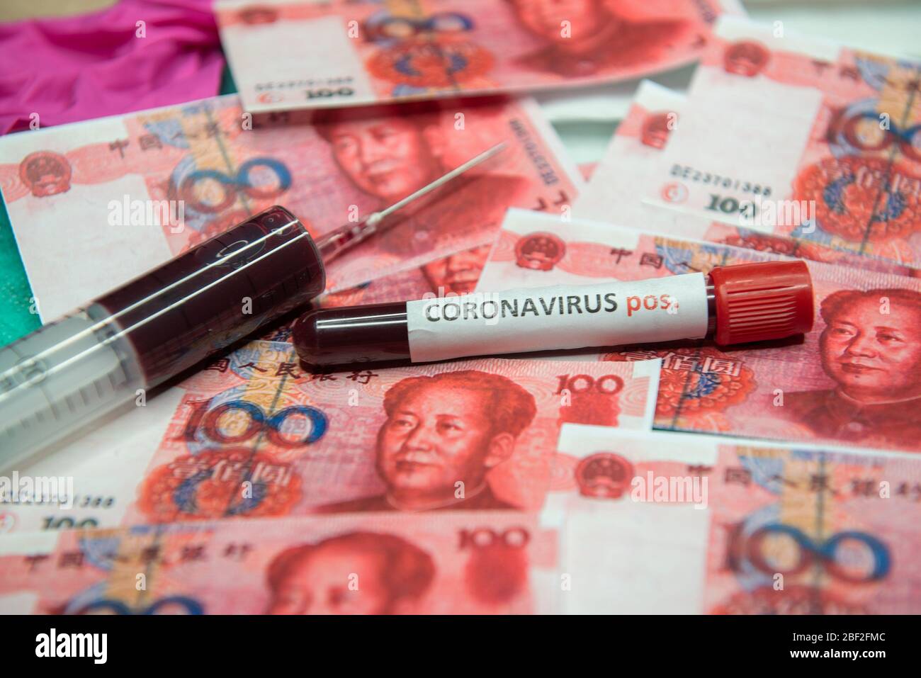 Chinese yuan and positive test at coronavirus. Stock Photo