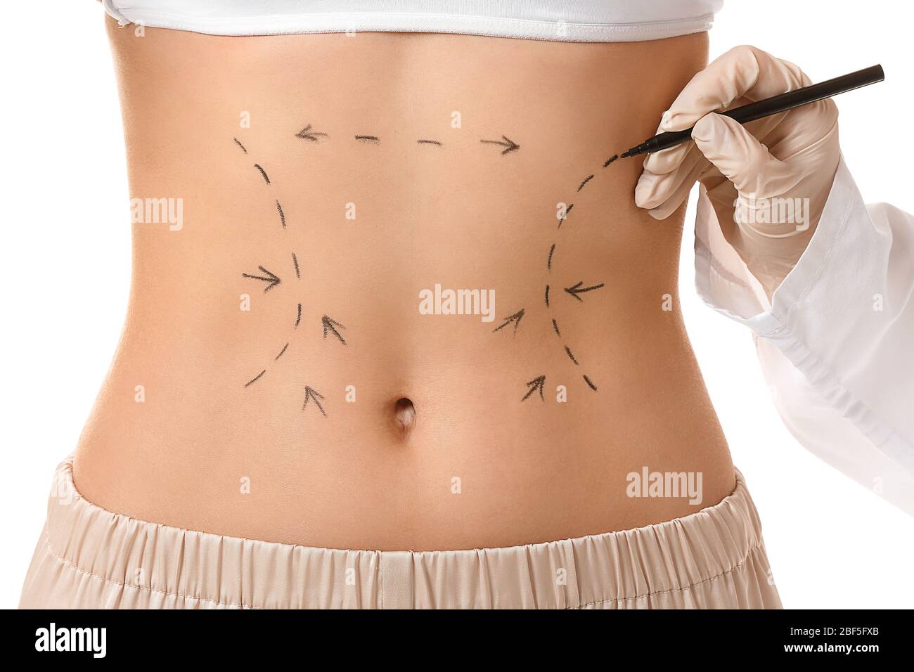 Plastic surgeon applying marking on female body against white background,  closeup Stock Photo - Alamy