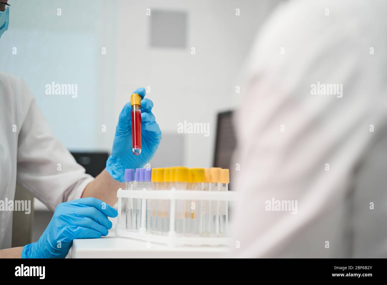 Close up of female hand that holding blood sample Stock Photo