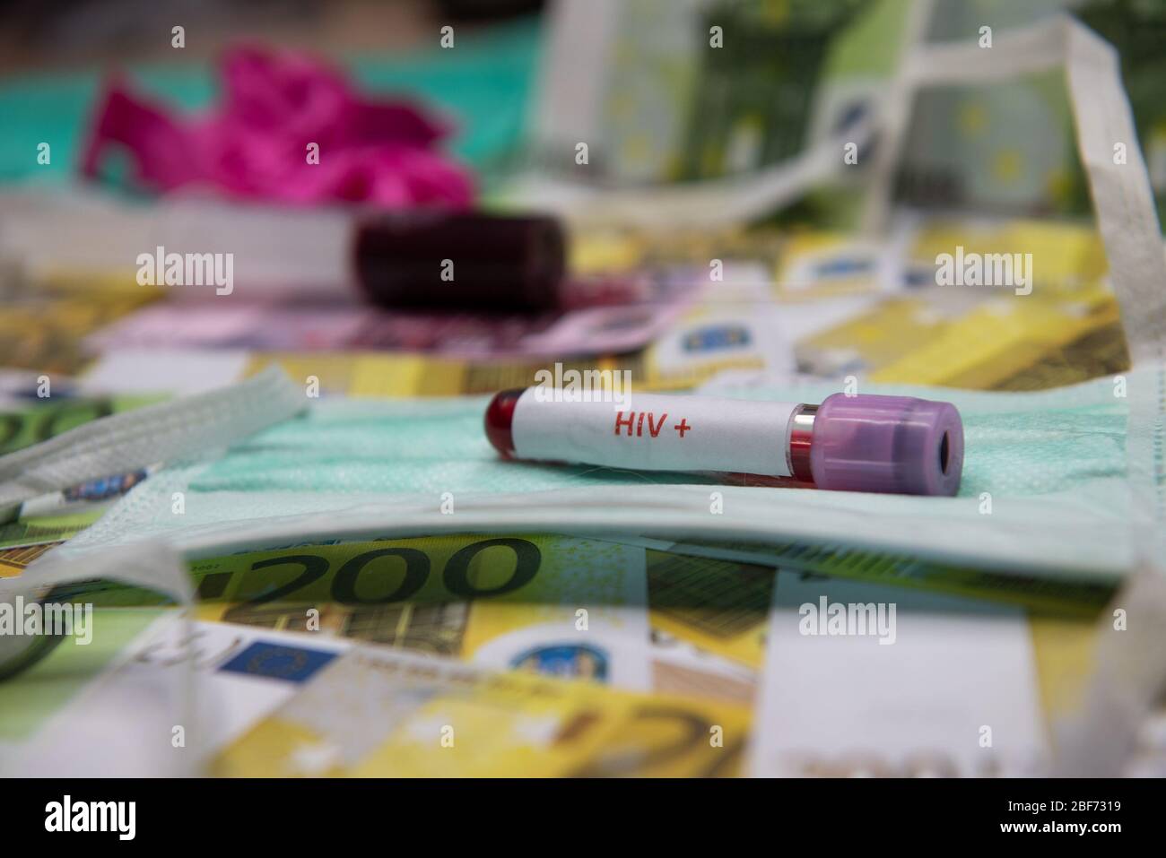 Euro money and tube with blood and positive test at HIV. Stock Photo