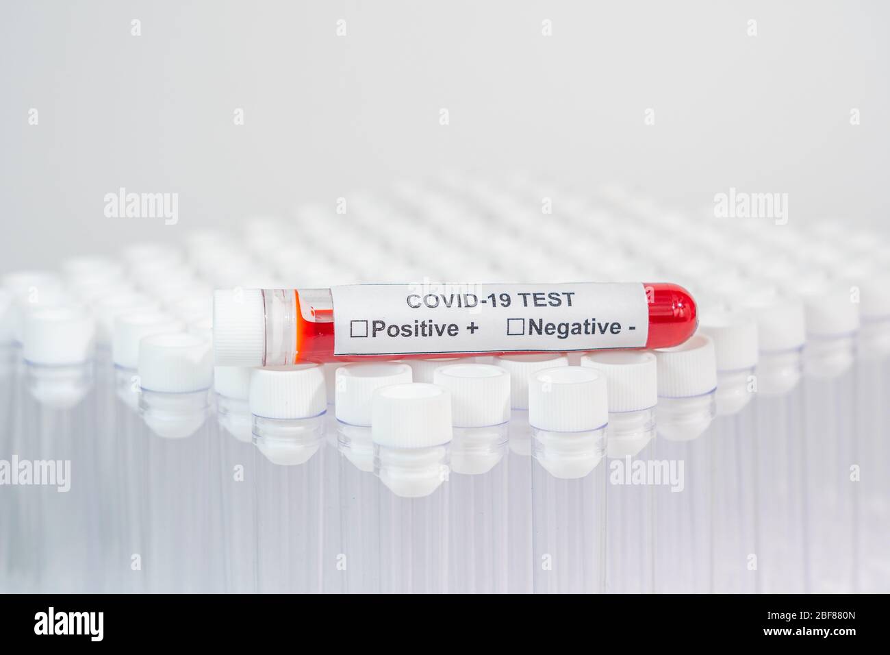 Blood sample in vacuum venipuncture tube for COVID19 test Stock Photo