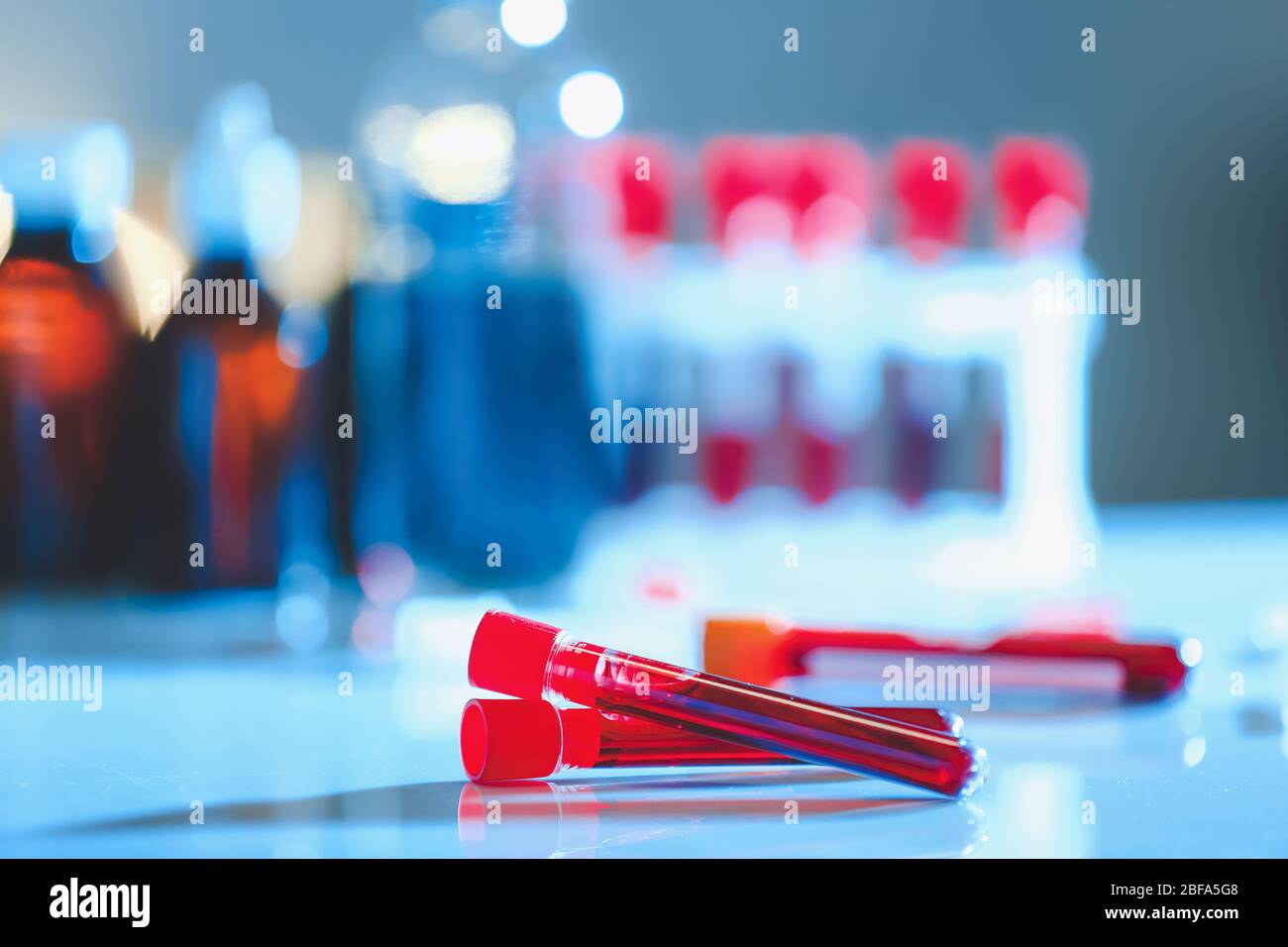 Test tubes with blood samples on table in laboratory Stock Photo - Alamy