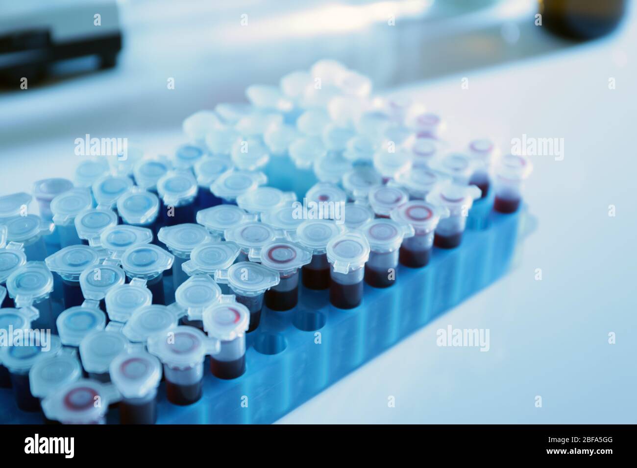 Test tubes with blood samples on table in laboratory Stock Photo - Alamy