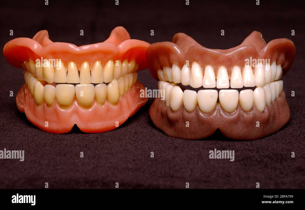 Two sets of full dentures. Dentures or false teeth are made from an
