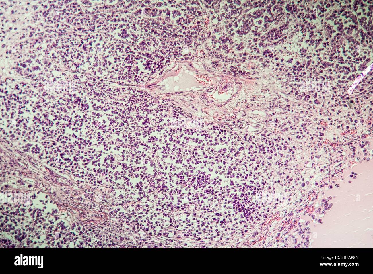 Spinal cord tissue section under the microscope 100x Stock Photo - Alamy