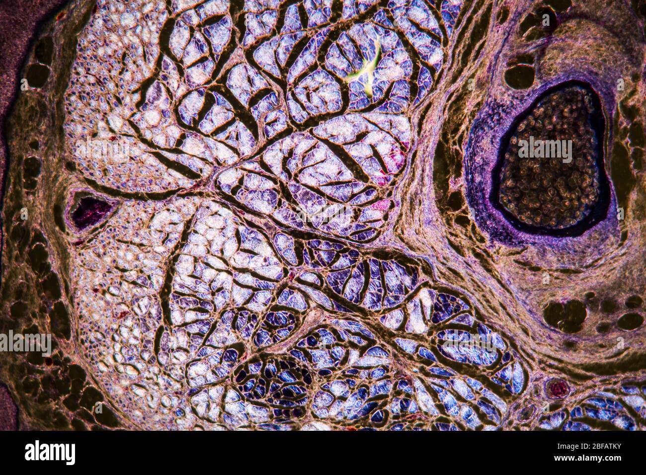 Brain cells in the dark field under the microscope 100x Stock Photo