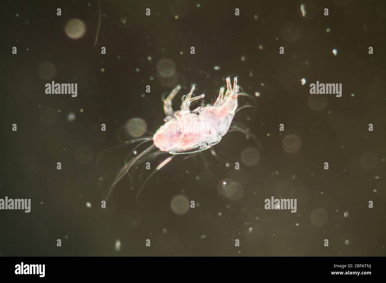 House Dust Mite Under The Microscope 100x Stock Photo Alamy House Dust Mite Under The Microscope 100x Stock Photo Alamy