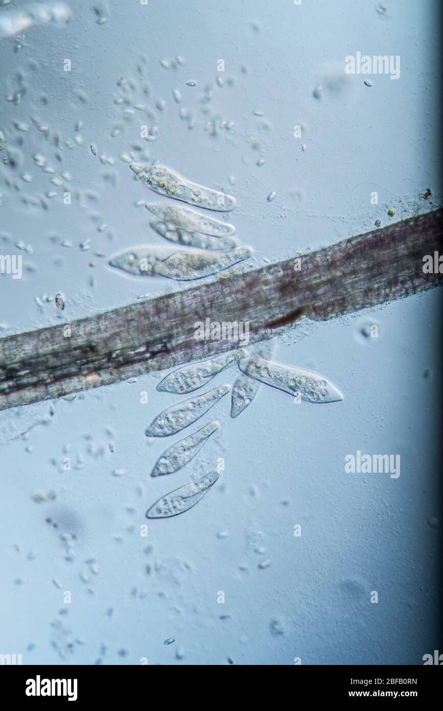 Ciliate plankton unicellular in drops of water 100x Stock Photo