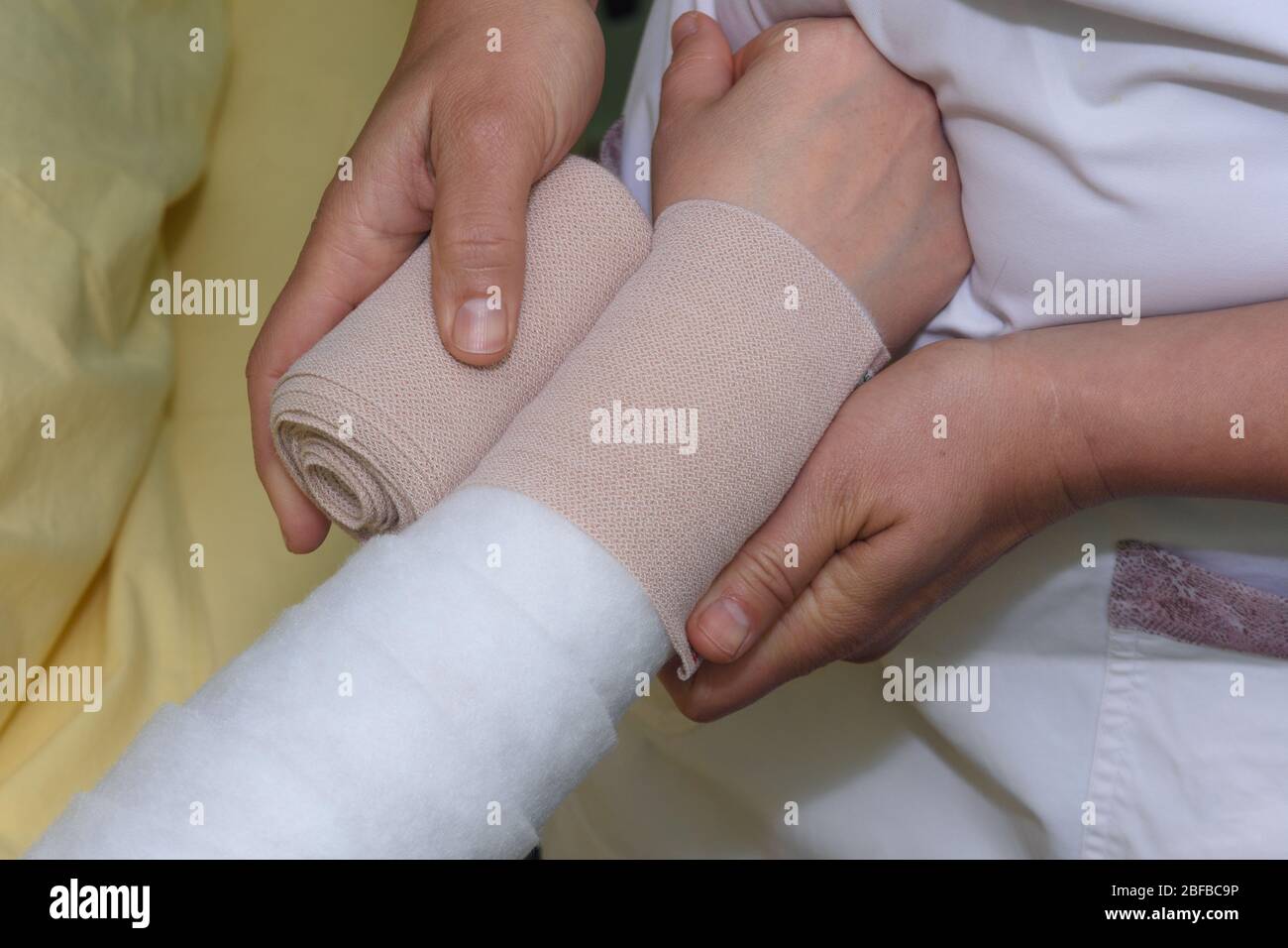 Lymphedema management Wrapping Lymphedema Hand and Arm using