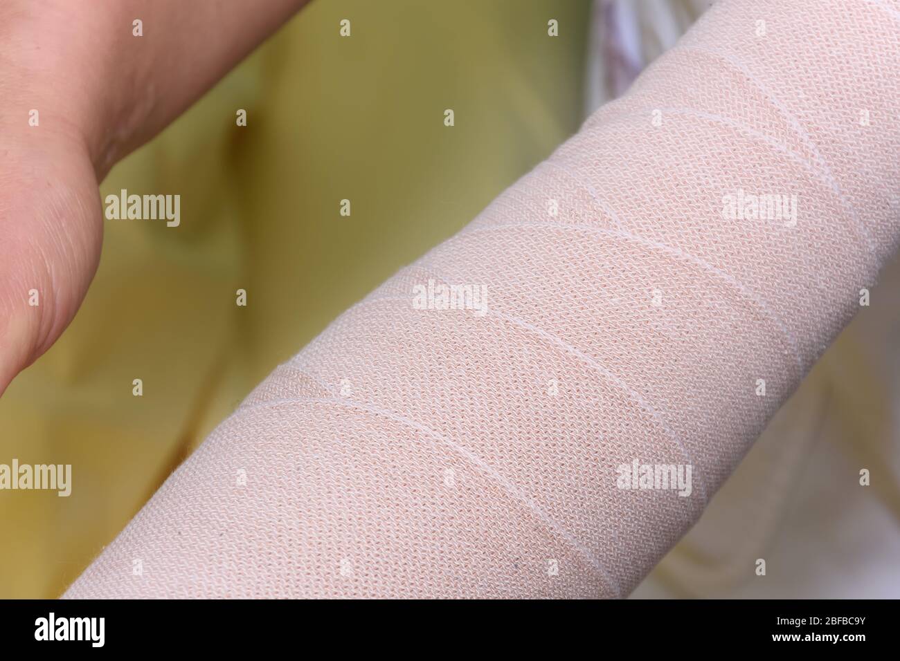 Lymphedema management Wrapping Lymphedema Hand and Arm using