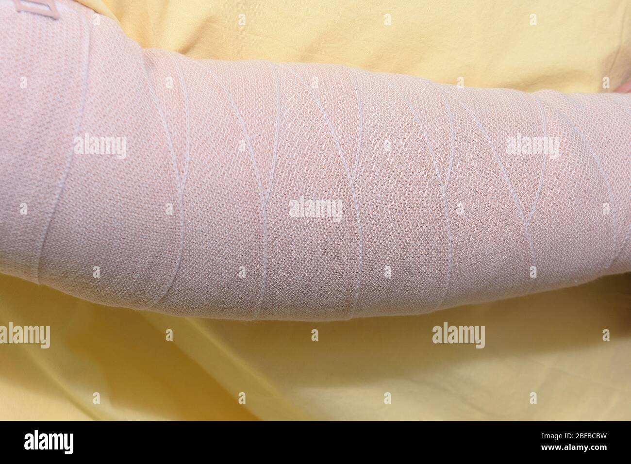 Lymphedema management Wrapping Lymphedema Hand and Arm using