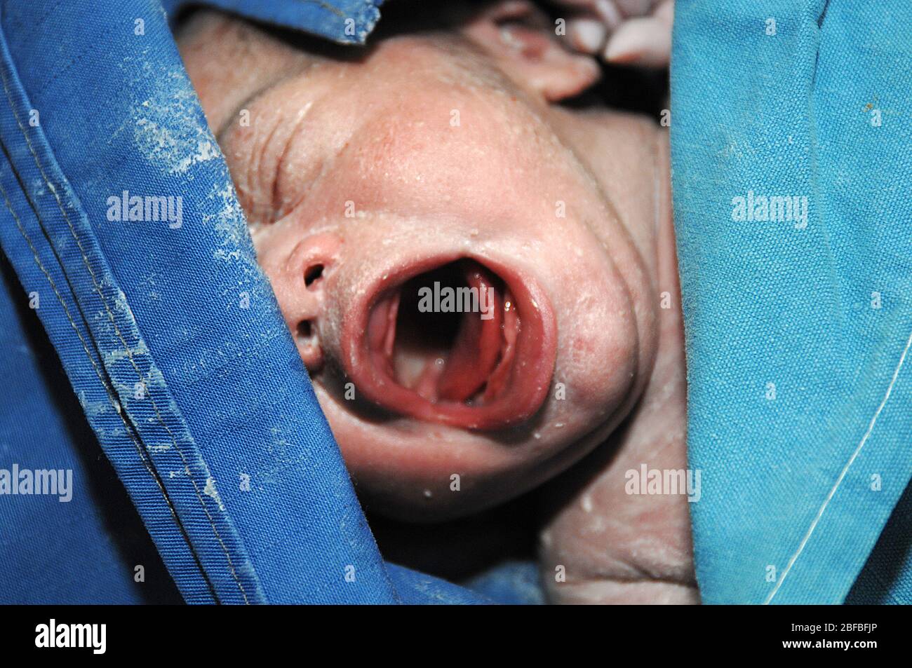 Close up of face of a new born baby, soon after birth. Stock Photo