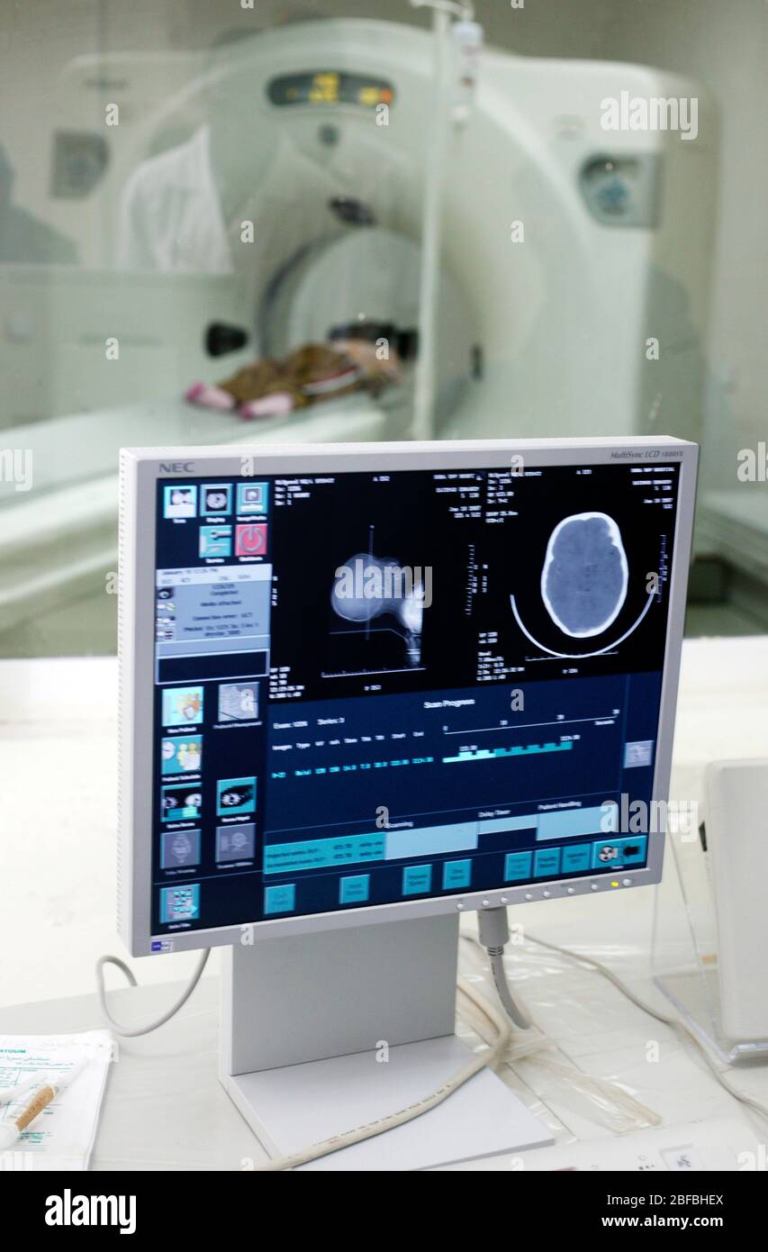 A patient undergoes a CT (Computer Tomography) scan  - Control screen of a CT scan (foreground) CT Scanner with patient (background) Stock Photo