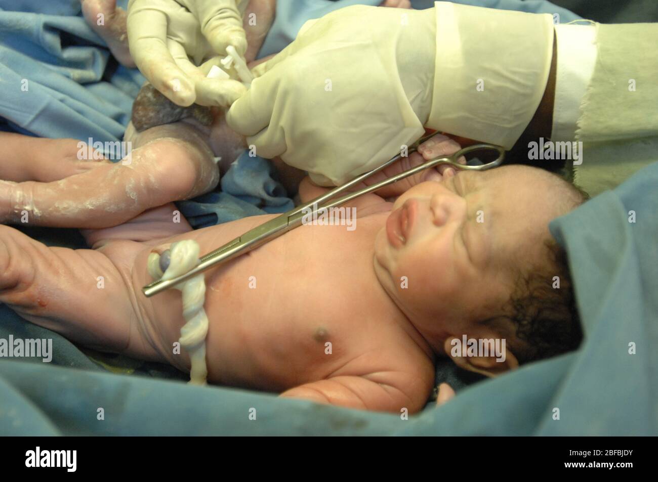 Surgeon Cutting The Umbilical Cord Of A Newborn Baby Stock Photo Alamy