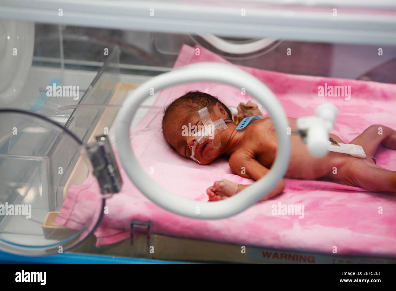 Premature Babies High Resolution Stock Photography And Images Alamy