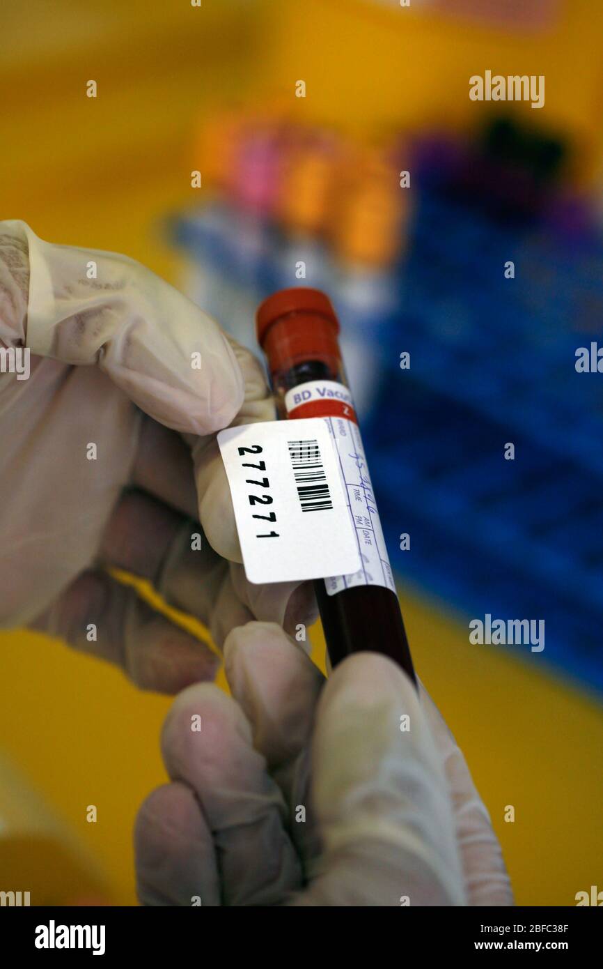 A pathologist labels blood samples in a test tube Stock Photo Alamy