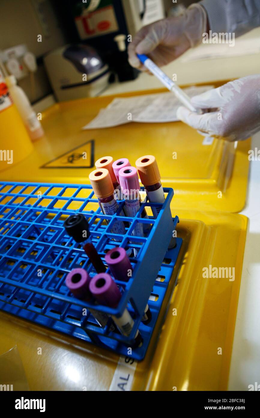 A small selection of blood filled phials in a rack holder. Preparation of blood samples Stock Photo