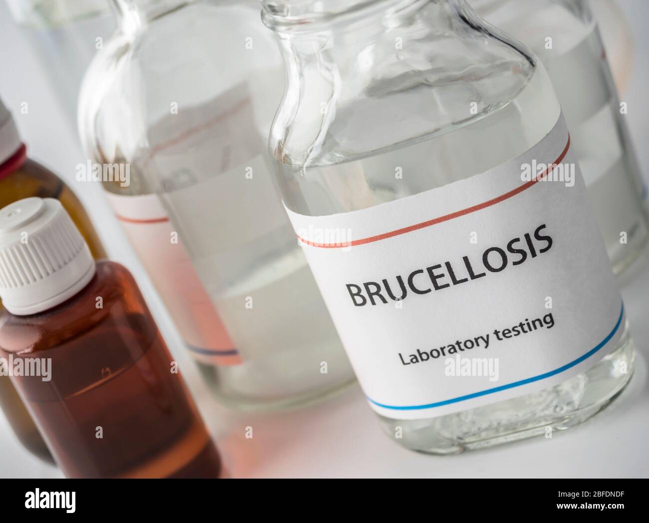 Test brucellosis in laboratory, conceptual image Stock Photo Alamy