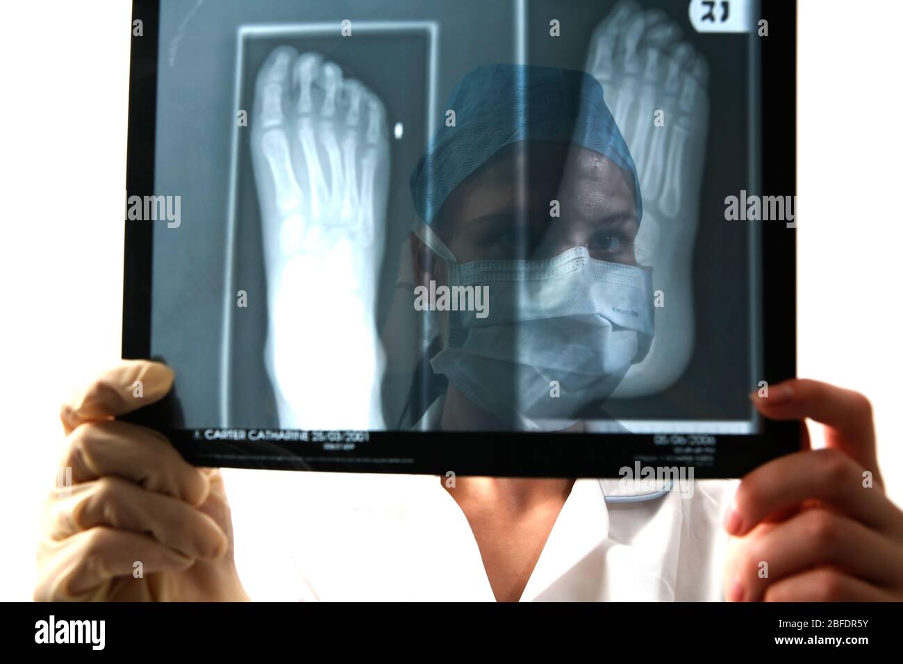A young surgeon examins an X-Ray of a foot. Stock Photo