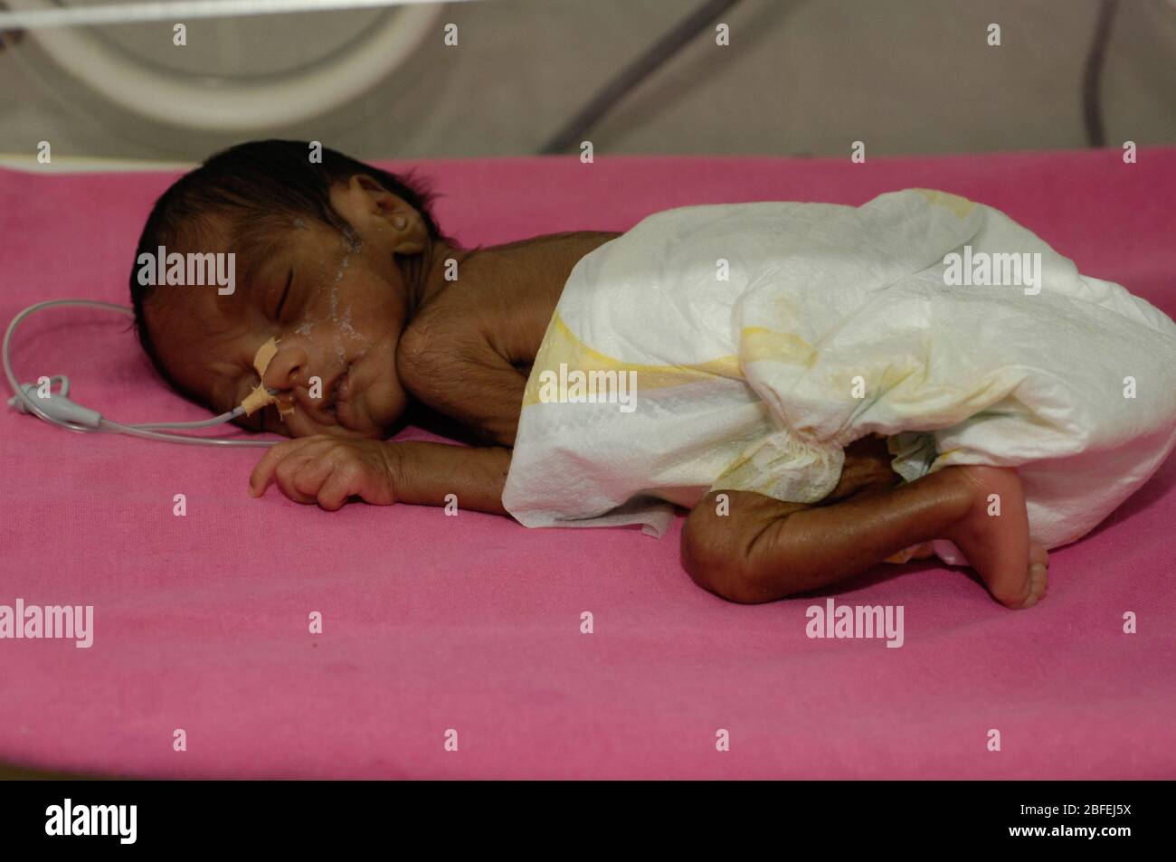 Premature baby in an incubator in the neonatal unit of a hospital. Premature babies are placed in incubator as they have not fully developed the mecha Stock Photo